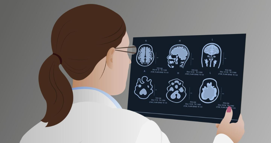 Brain scan illustration